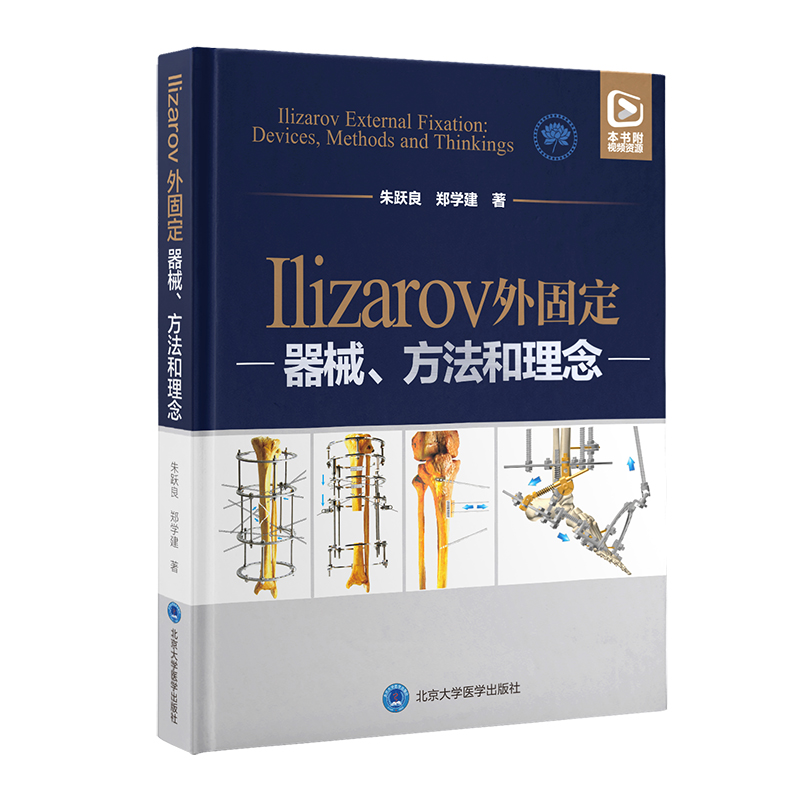 Ilizarov̶е