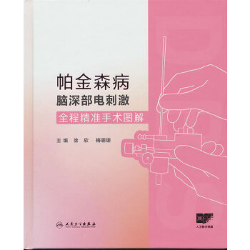  ����ɭ���X�늴̼�ȫ�̾���(zh��n)���g(sh��)�D��