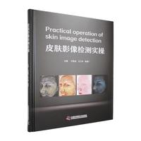  Ƥ�wӰ��z�y(c��)��(sh��)�� Ƥ�w���R����(sh��)�ù��ߕ�(sh��)