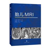 ̥��MRI