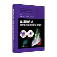 Ѫ��(x��)���������Ͱ����D�V�cҎ(gu��)������(b��o)��