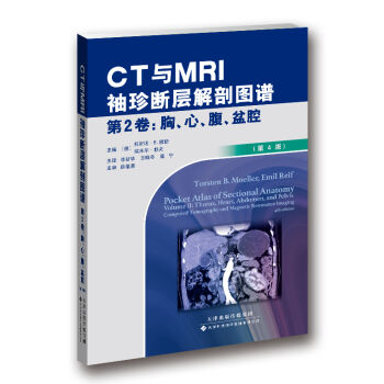 CTcMRIӽʈDV 2-ءǻ