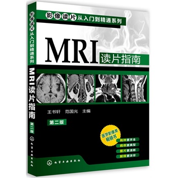 ӰxƬT(mn)ͨϵ--MRIxƬָ(ڶ)(t(y)W(xu)ӰN(sh)(j)ٰNRȫDƬጸԔM)